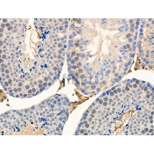 Phospho-UBA52 (Ser65) Antibody -AF3888