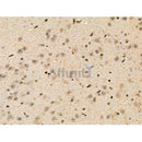 Phospho-Parkin (Ser378) Antibody -AF3889