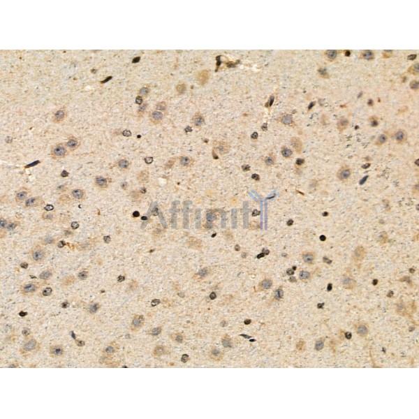 Phospho-Parkin (Ser378) Antibody -AF3889