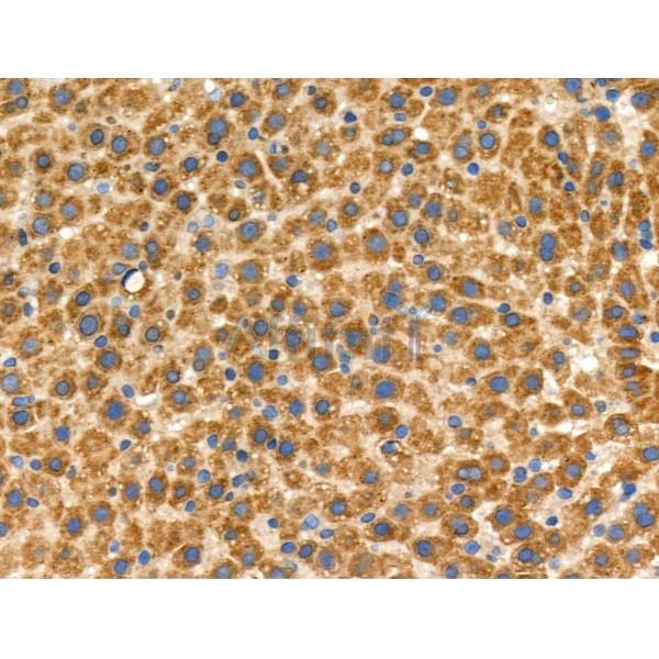 Phospho-ROCK1 (Thr455/Thr456) Antibody -AF3895