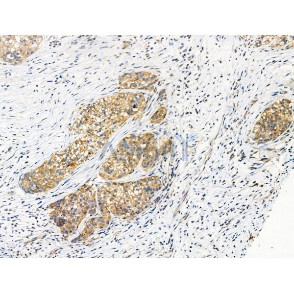 Phospho-Transferrin Receptor (Tyr20) Antibody -AF3896