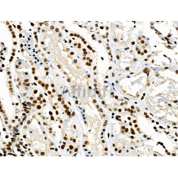 Phospho-Smad5 (Ser463/Ser465) Antibody -AF3899