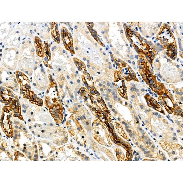 Phospho-MLKL (Ser345) Antibody -AF3902