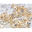 Phospho-MLKL (Thr349) Antibody -AF3904