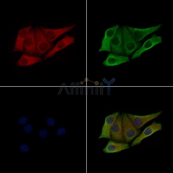 Phospho-IRF3 (Ser385) Antibody -AF3910