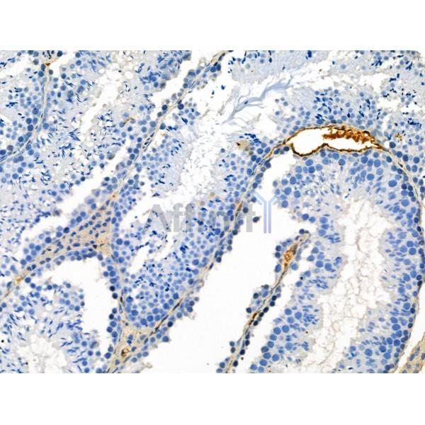 Phospho-CRMP2 (Ser522) Antibody -AF3912