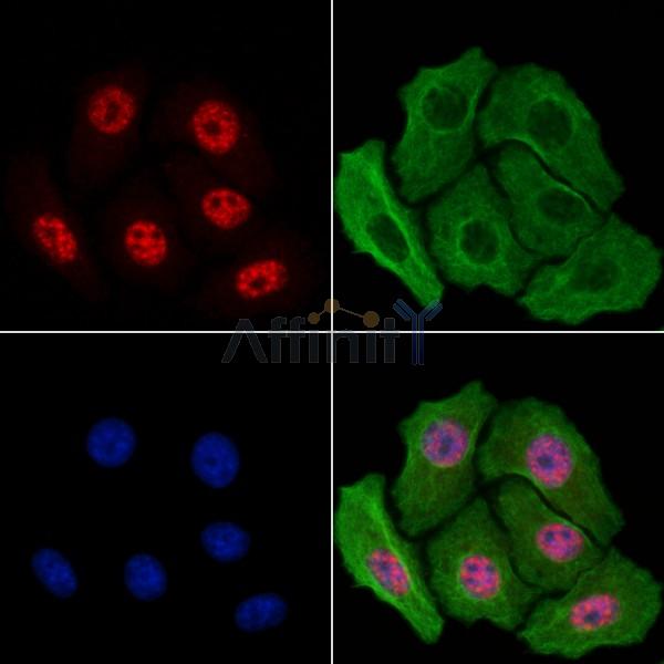 Phospho-Tau (Thr217/Thr534) Antibody -AF3913