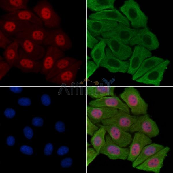 Phospho-BRCA2 (Ser3291) Antibody -AF3914