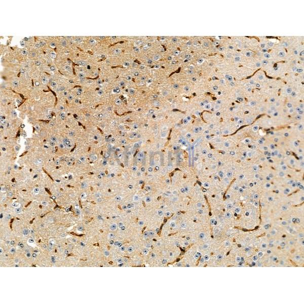 Phospho-NCF1/p47-phox (Ser345) Antibody -AF3917