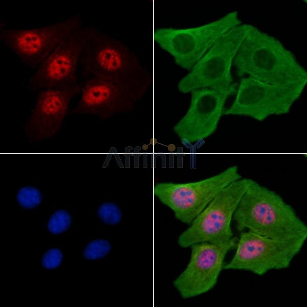 Phospho-ETS1 (Thr38) Antibody -AF3918