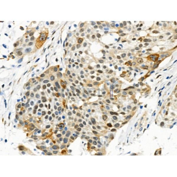 Phospho-UBF1 (Ser484) Antibody -AF3925