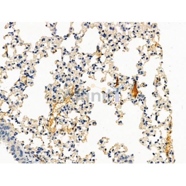Phospho-IL-2R beta/CD122 (Tyr364) Antibody -AF3926