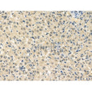 Phospho-HSF1 (Thr142) Antibody -AF3932