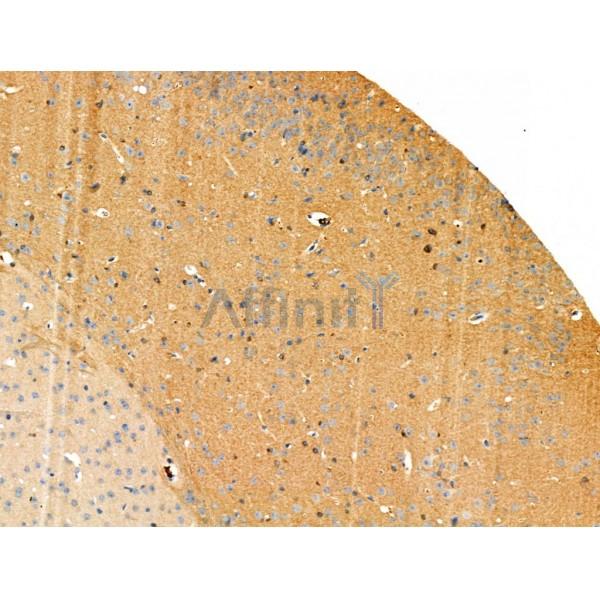 Phospho-TUBA1/3/4 (Tyr272) Antibody -AF3944