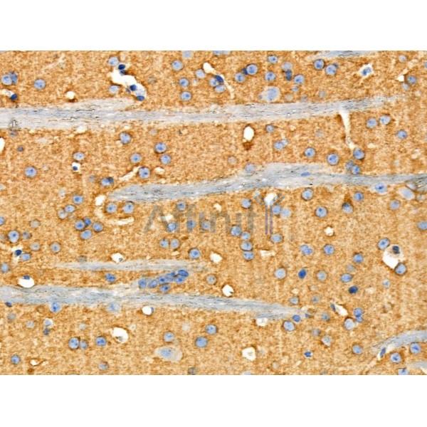 Phospho-PKA-R2 beta (Ser114) Antibody -AF3952