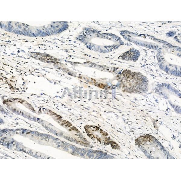 Phospho-HP1 alpha (Ser92) Antibody -AF3957