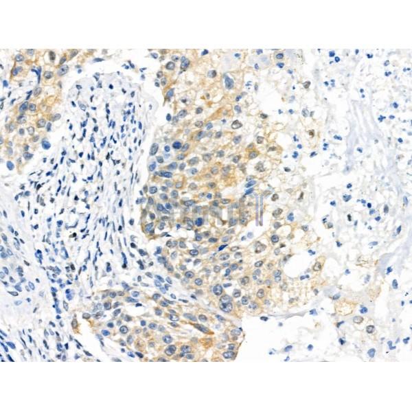 Phospho-PEA15 (Ser104) Antibody -AF3963
