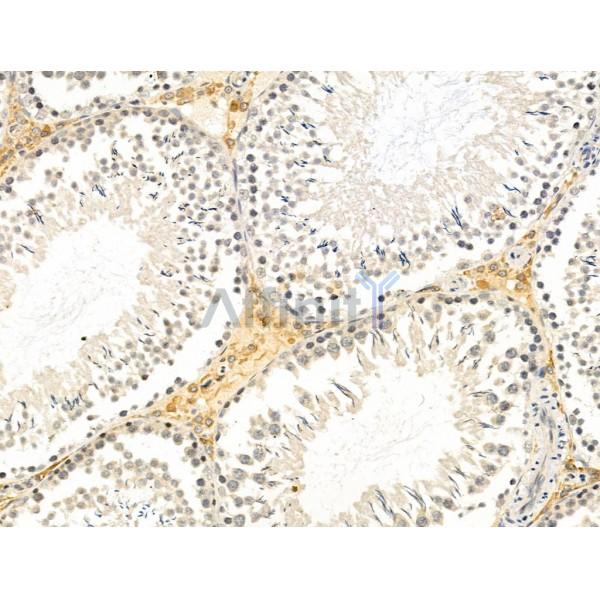 Phospho-EPHA3/4/5 (Tyr779/Tyr833) Antibody -AF3967