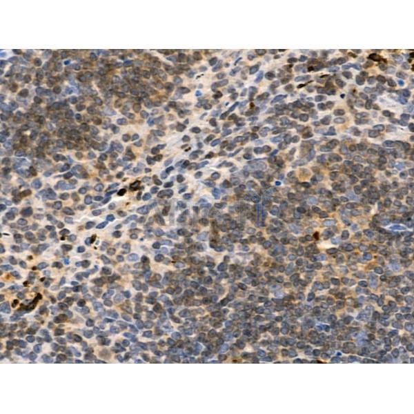 Phospho-p63 (Ser395) Antibody -AF3976