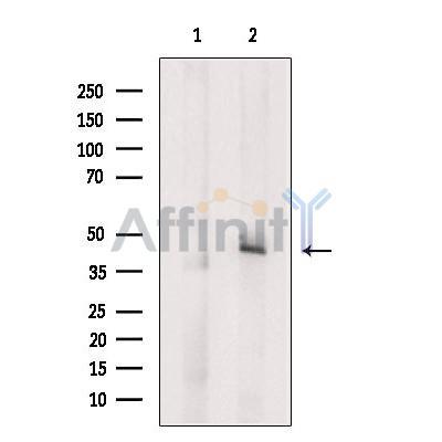 Cleaved Caspase-9 (Asp315)  Antibody