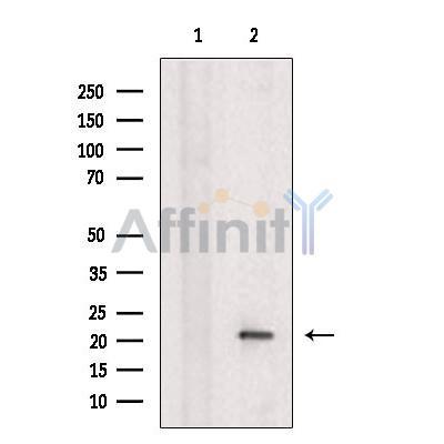 Cleaved Caspase-7 (Asp198)