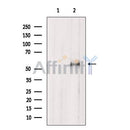 Western blot analysis of extracts from Mouse  kidney, using TRAF3 Antibody. The lane on the left was treated with blocking peptide.

Observed bands: 55 kDa.