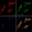 Western blot analysis of extracts from Rat heart, using Keratin 16 Antibody. The lane on the left was treated with blocking peptide.