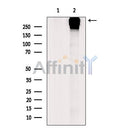 AF5498 at 1/100 staining Human heart tissue by IHC-P. The sample was formaldehyde fixed and a heat mediated antigen retrieval step in citrate buffer was performed. The sample was then blocked and incubated with the antibody for 1.5 hours at 22¡ãC. An HRP conjugated goat anti-rabbit antibody was used as the secondary