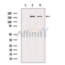 Western blot analysis of extracts from various samples, using EGFR Antibody.
 Lane 1: 293 treated with blocking peptide;
 Lane 2: 293;
 Lane 3: B16F10.