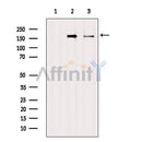 Western blot analysis of extracts from various samples, using EGFR Antibody.
 Lane 1: VERO treated with blocking peptide;
 Lane 2: VERO;
 Lane 3: HUVEC.