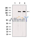 Western blot analysis of extracts from various samples, using EGFR Antibody.  Lane 1: VERO treated with blocking peptide;  Lane 2: VERO; Lane 3: HepG2.