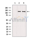 Western blot analysis of extracts from various samples, using EGFR Antibody.
 Lane 1: VERO treated with blocking peptide;
 Lane 2: VERO;
Lane 3: HepG2.