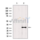 Western blot analysis of extracts from Mouse lung, using HSP27 Antibody. Lane 1 was treated with the blocking peptide.