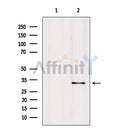 AF6111 staining Hela by IF/ICC. The sample were fixed with PFA and permeabilized in 0.1% Triton X-100,then blocked in 10% serum for 45 minutes at 25¡ãC. The primary antibody was diluted at 1/200 and incubated with the sample for 1 hour at 37¡ãC. An  Alexa Fluor 594 conjugated goat anti-rabbit IgG (H+L) Ab, diluted at 1/600, was used as the secondary antibod