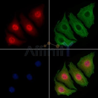 Bcl-2 Antibody -AF6138