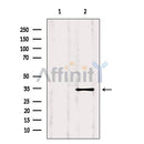 Western blot analysis of extracts from 293, using ATF2 Antibody. Lane 1 was treated with the blocking peptide.