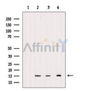 AF6187 at 1/200 staining human lymph cancer tissue sections by IHC-P. The tissue was formaldehyde fixed and a heat mediated antigen retrieval step in citrate buffer was performed. The tissue was then blocked and incubated with the antibody for 1.5 hours at 22¡ãC. An HRP conjugated goat anti-rabbit antibody was used as the secondary