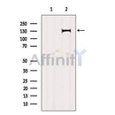 AF6192 at 1/100 staining Human prostate tissue by IHC-P. The sample was formaldehyde fixed and a heat mediated antigen retrieval step in citrate buffer was performed. The sample was then blocked and incubated with the antibody for 1.5 hours at 22¡ãC. An HRP conjugated goat anti-rabbit antibody was used as the secondary