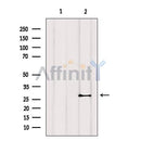 AF6214 at 1/100 staining Human prostate tissue by IHC-P. The sample was formaldehyde fixed and a heat mediated antigen retrieval step in citrate buffer was performed. The sample was then blocked and incubated with the antibody for 1.5 hours at 22¡ãC. An HRP conjugated goat anti-rabbit antibody was used as the secondary