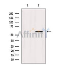 Western blot analysis of extracts from MCF7, using p70 S6 Kinase Antibody. Lane 1 was treated with the blocking peptide.