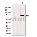 Western blot analysis of extracts from HepG2, using Shc Antibody. Lane 1 was treated with the blocking peptide.