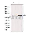 Western blot analysis of extracts from B16F10, using akt1Antibody. Lane 1 was treated with the blocking peptide.