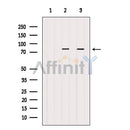 Western blot analysis of extracts from various samples, using Catenin-beta Antibody.
 Lane 1: Hela cells treated with blocking peptide;
 Lane 2: Hela cells;
Lane 3: 293 cells;