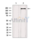 Western blot analysis of extracts from HepG2, using EGFR2 Antibody. Lane 1 was treated with the blocking peptide.