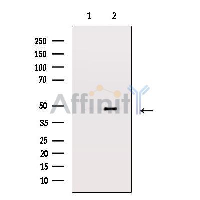 SEK1/MKK4 Antibody