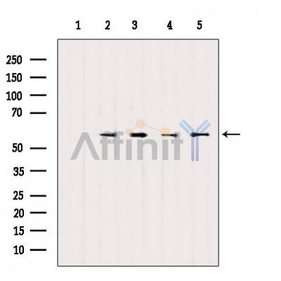 AF6330 staining 293 by IF/ICC. The sample were fixed with PFA and permeabilized in 0.1% Triton X-100,then blocked in 10% serum for 45 minutes at 25¡ãC. The primary antibody was diluted at 1/200 and incubated with the sample for 1 hour at 37¡ãC. An  Alexa Fluor 594 conjugated goat anti-rabbit IgG (H+L) Ab, diluted at 1/600, was used as the secondary antibod