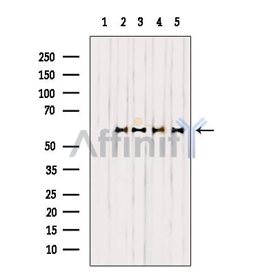 Western blot analysis of extracts from various samples, using EFNB1/2 Antibody.
 Lane 1: Mouse brain treated with blocking peptide;
 Lane 2: Mouse brain;
Lane 3: HepG2.