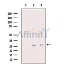 AF6356 at 1/100 staining Human brain tissue by IHC-P. The sample was formaldehyde fixed and a heat mediated antigen retrieval step in citrate buffer was performed. The sample was then blocked and incubated with the antibody for 1.5 hours at 22¡ãC. An HRP conjugated goat anti-rabbit antibody was used as the secondary