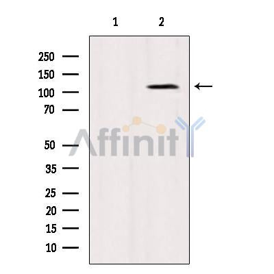 Western blot analysis of extracts from VERO, using FAK Antibody. Lane 1 was treated with the blocking peptide.