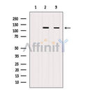 Western blot analysis of extracts from various samples, using FAK Antibody.
 Lane 1: B16F10 cells treated with blocking peptide;
 Lane 2: B16F10 cells;
Lane 3: Hybridoma cells;